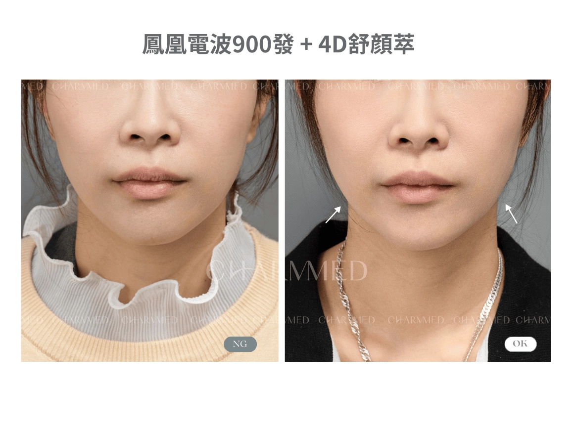 複合式醫美療程