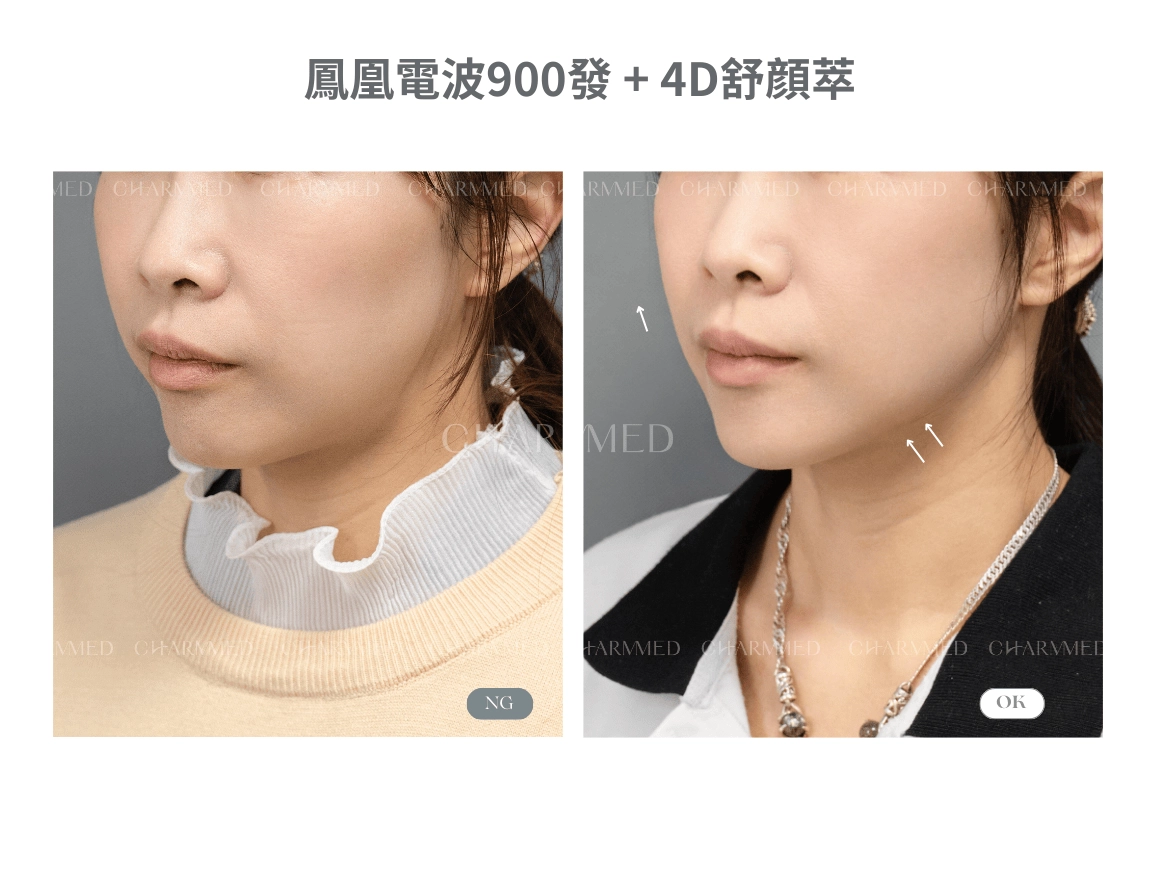 複合式醫美療程