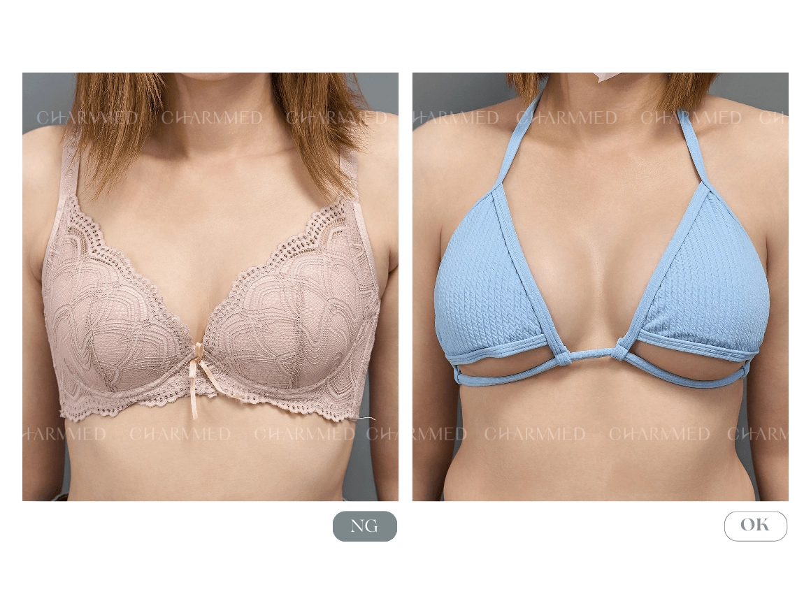 繆思女神波 -蔡青穎醫師隆乳案例