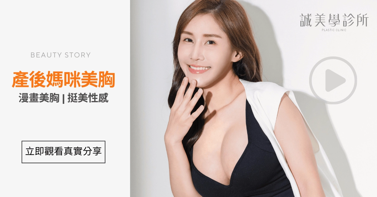 台中誠美學診所林孟羲醫師產後隆乳案例分享影片-motiva魔滴, 台中 隆乳