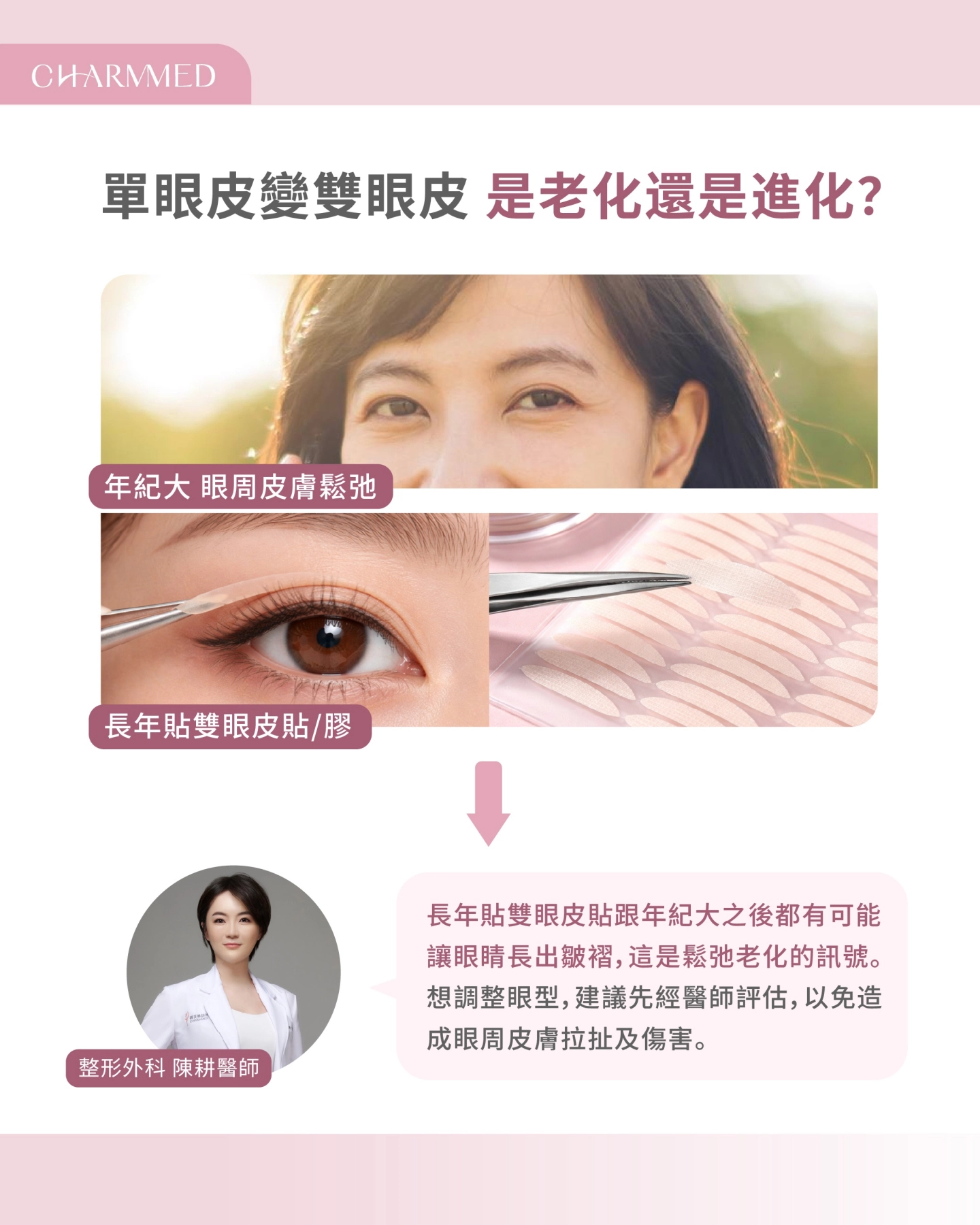 誠美學診所陳耕醫師雙眼皮