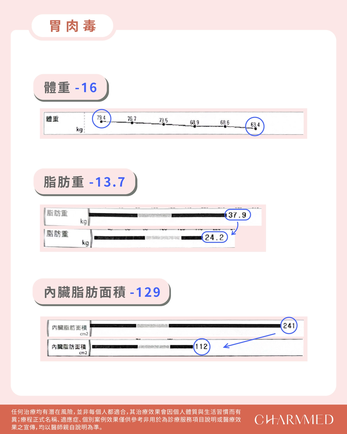 誠美學診所胃肉毒減重成果體重變化