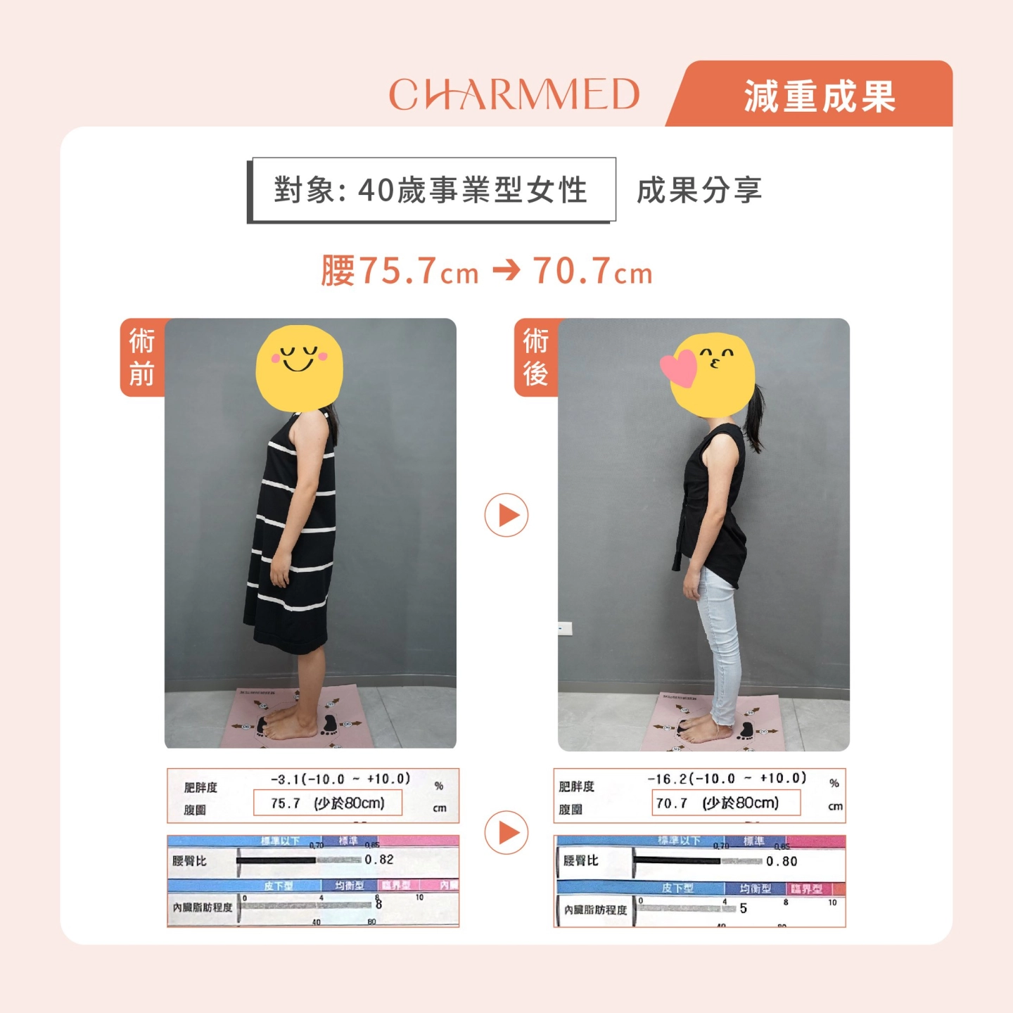 台中誠美學診所-胃水球減重個案成果數據