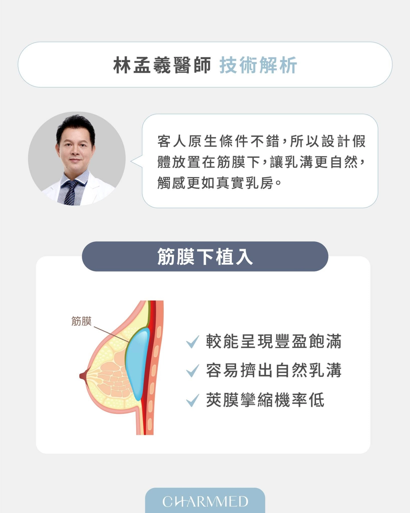 珍珠波隆乳有哪些特色?自然、柔軟與穩定兼具