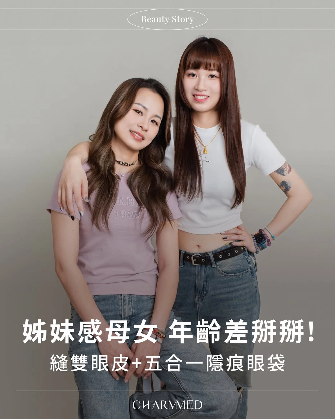 誠美學診所母女雙眼皮眼袋手術