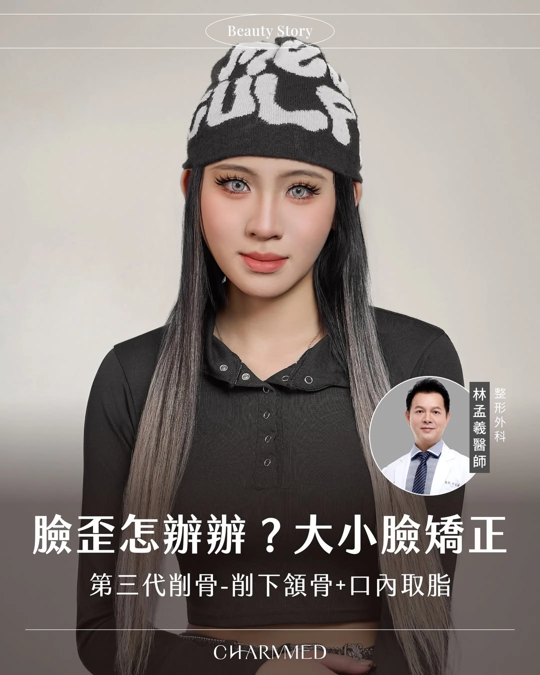 大小臉怎麼辦？第三代削骨矯正臉部不對稱