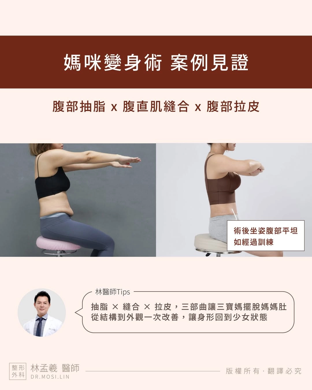 媽咪變身術:坐著也能維持平坦感!