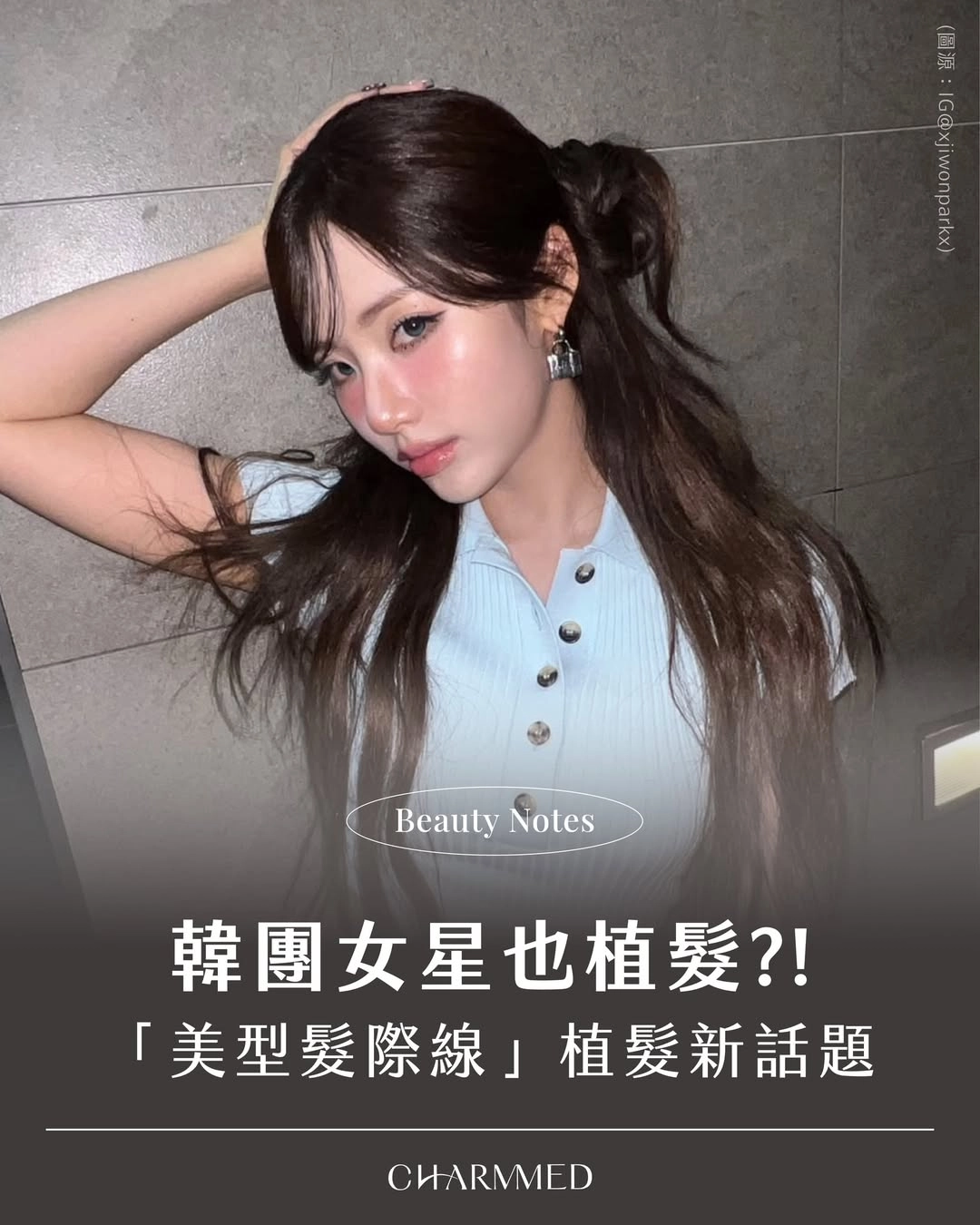 台中誠美學診所女性植髮新話題