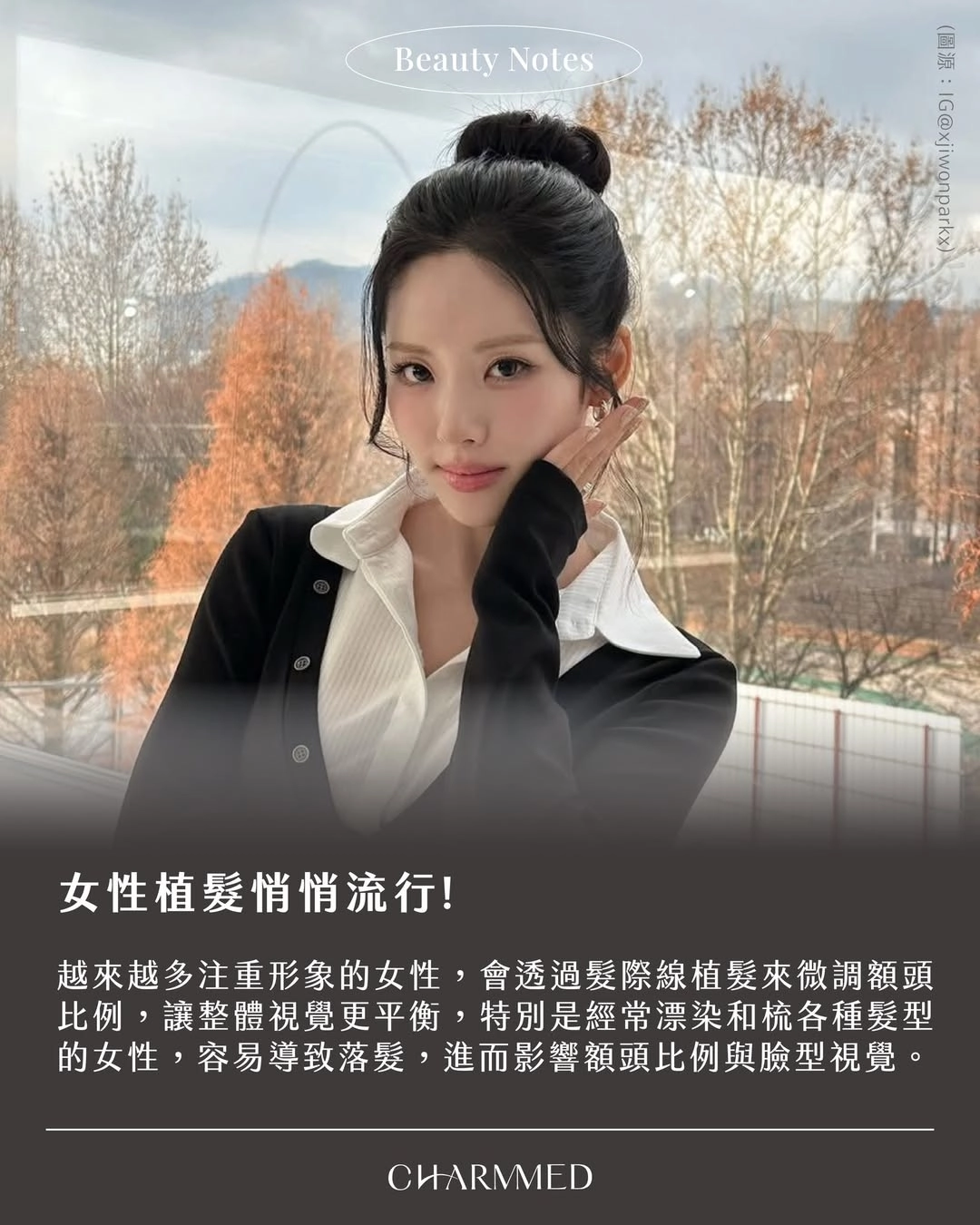 台中誠美學診所女性植髮新話題髮型