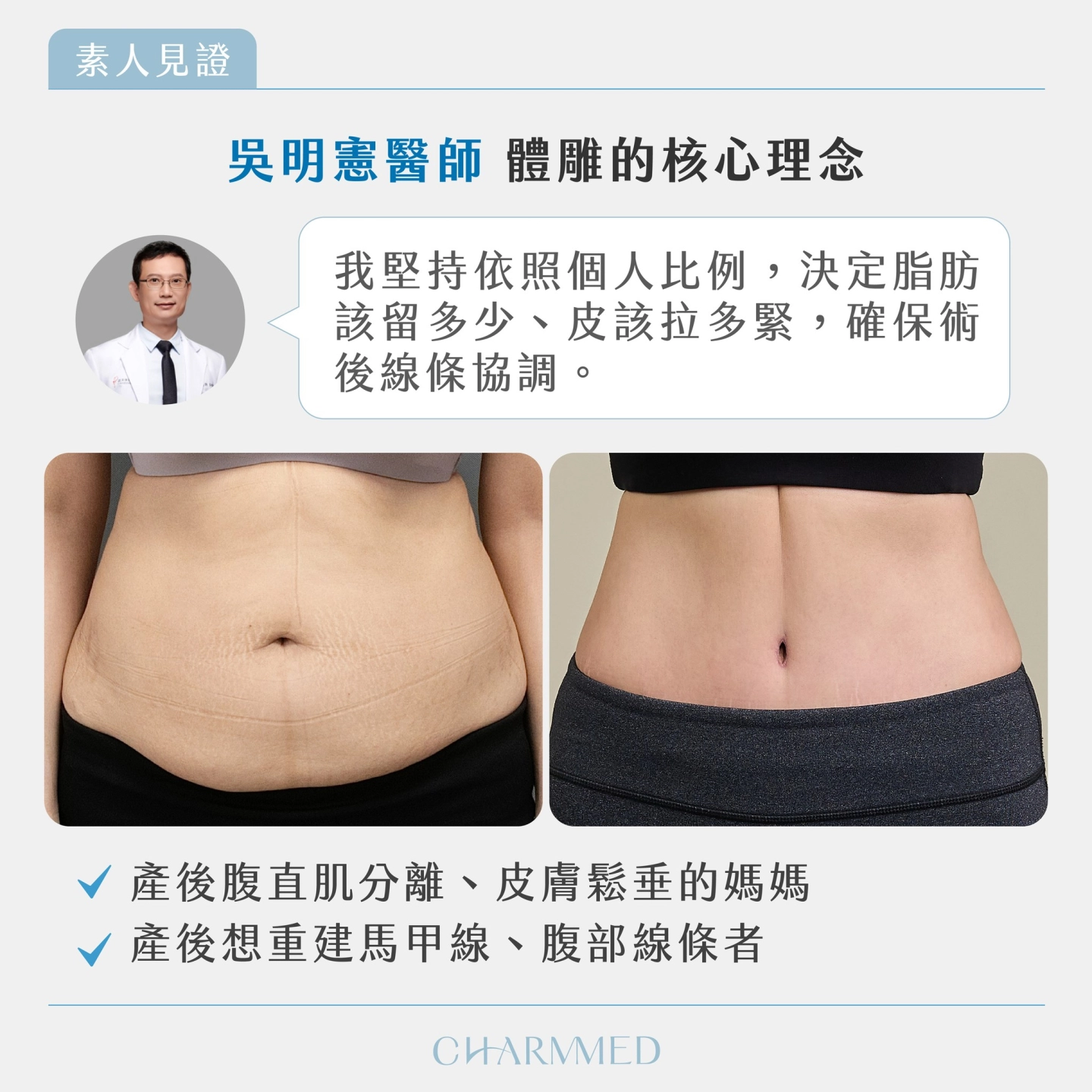 資深整形外科吳明憲醫師 產後腹部拉皮體雕規劃及個人技術解析-台中 誠美學診所 整形外科衛教
