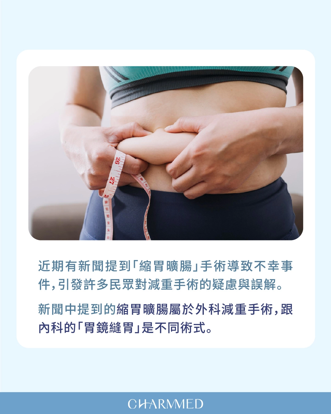 新聞提到的縮胃曠腸跟誠美學胃鏡縫胃是不一樣的