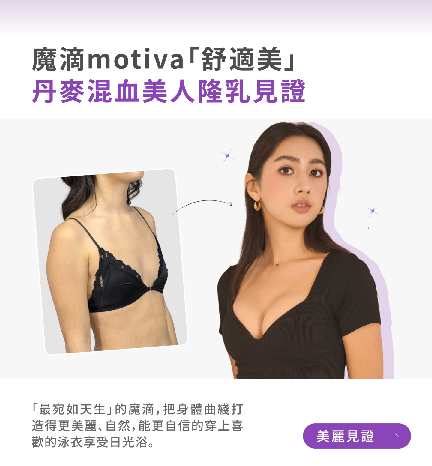 台中 誠美學林孟羲醫師魔滴隆乳真實案例美麗見證