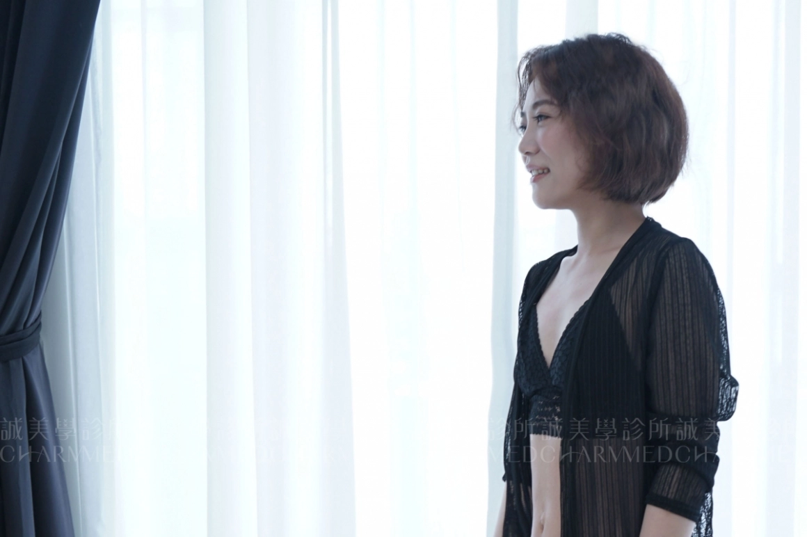 台中誠美學診所林孟羲醫師-產後魔滴隆乳真實案例術前