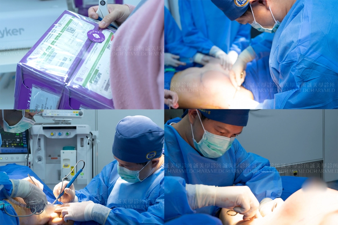 台中誠美學診所林孟羲醫師隆乳手術畫面分享
