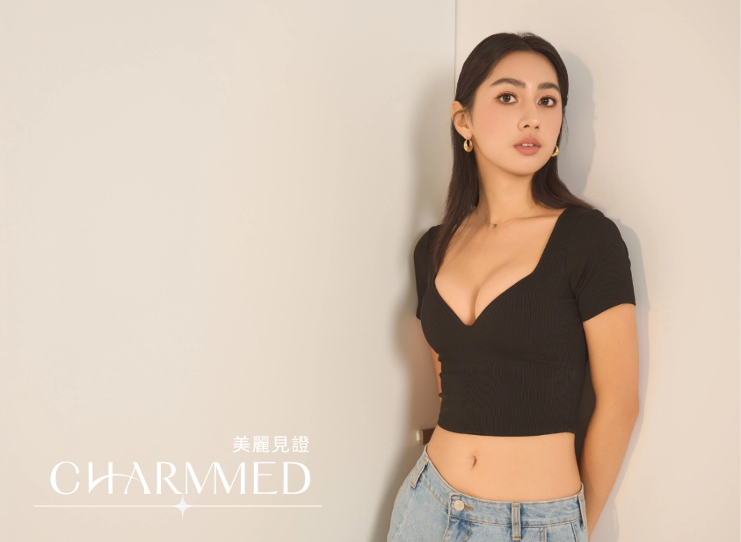 誠美學魔滴motiva隆乳效果
