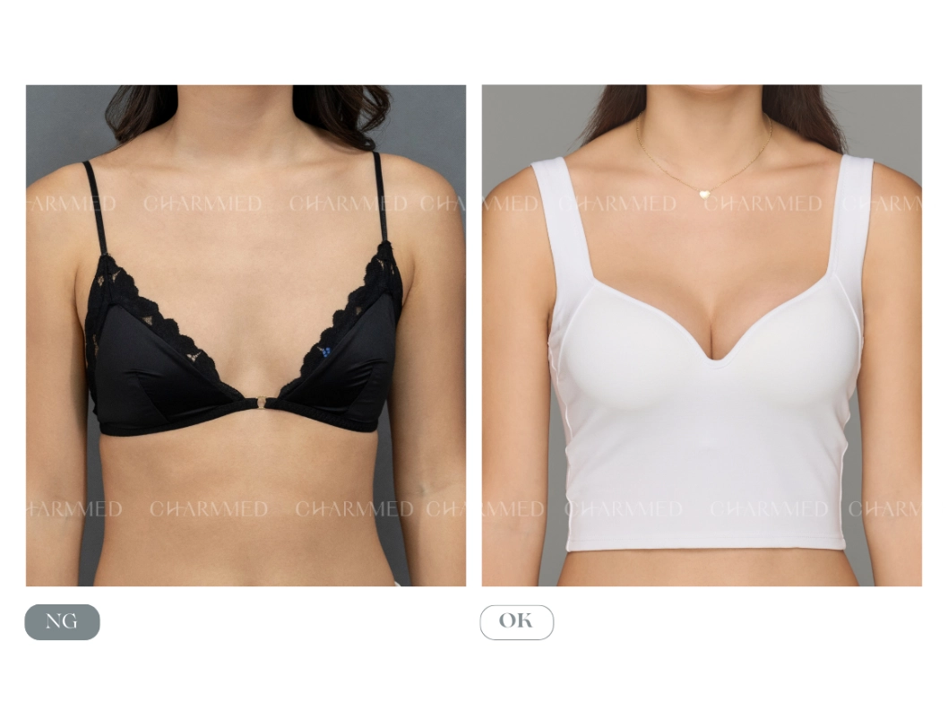 誠美學魔滴motiva隆乳前後對比