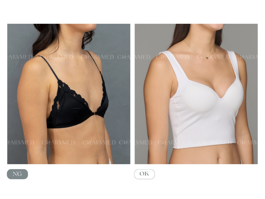 誠美學魔滴motiva隆乳效果圖