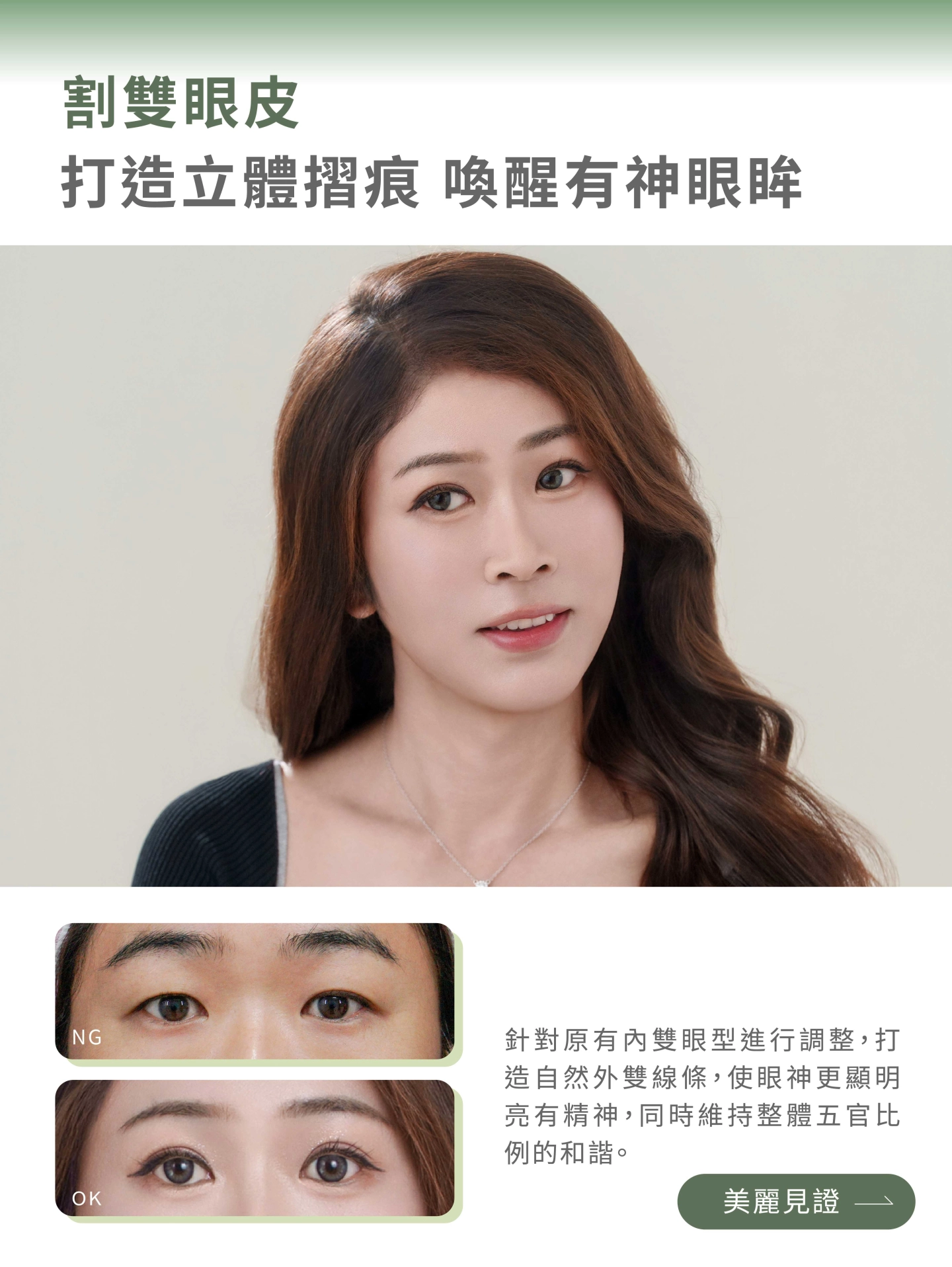誠美學診所割雙眼皮