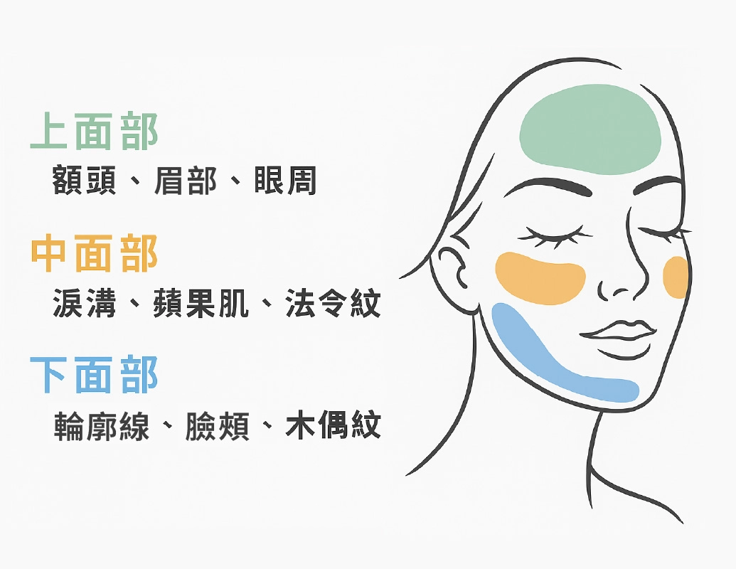 誠美學診所臉部拉皮部位