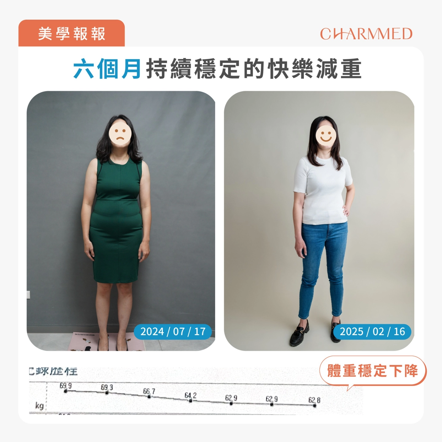 誠美學胃肉毒減重見證六個月效果