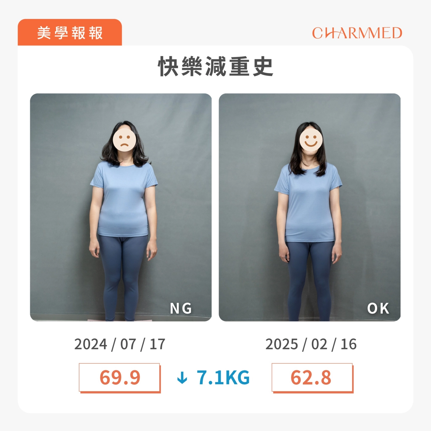 誠美學胃肉毒快樂減重史