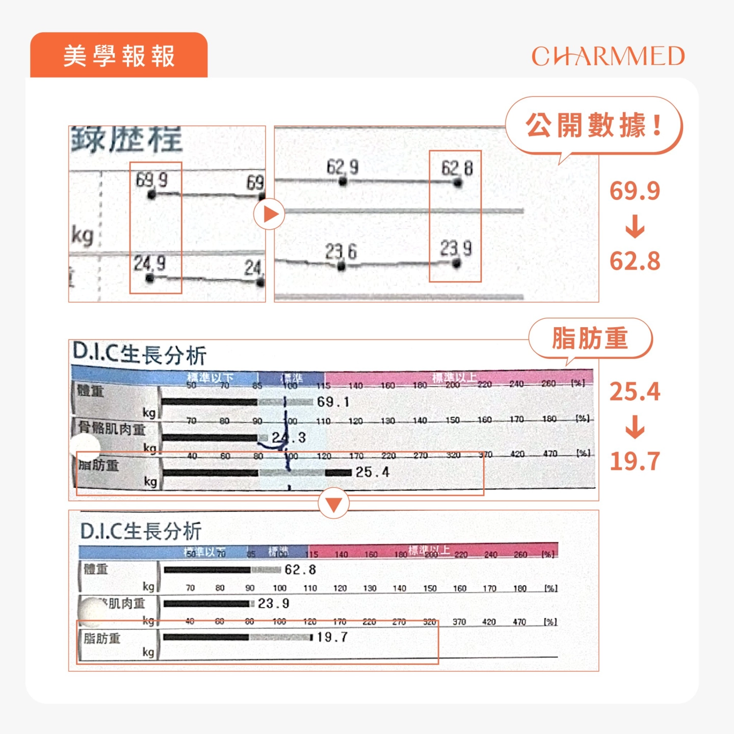 誠美學胃肉毒快樂減重史公開數據