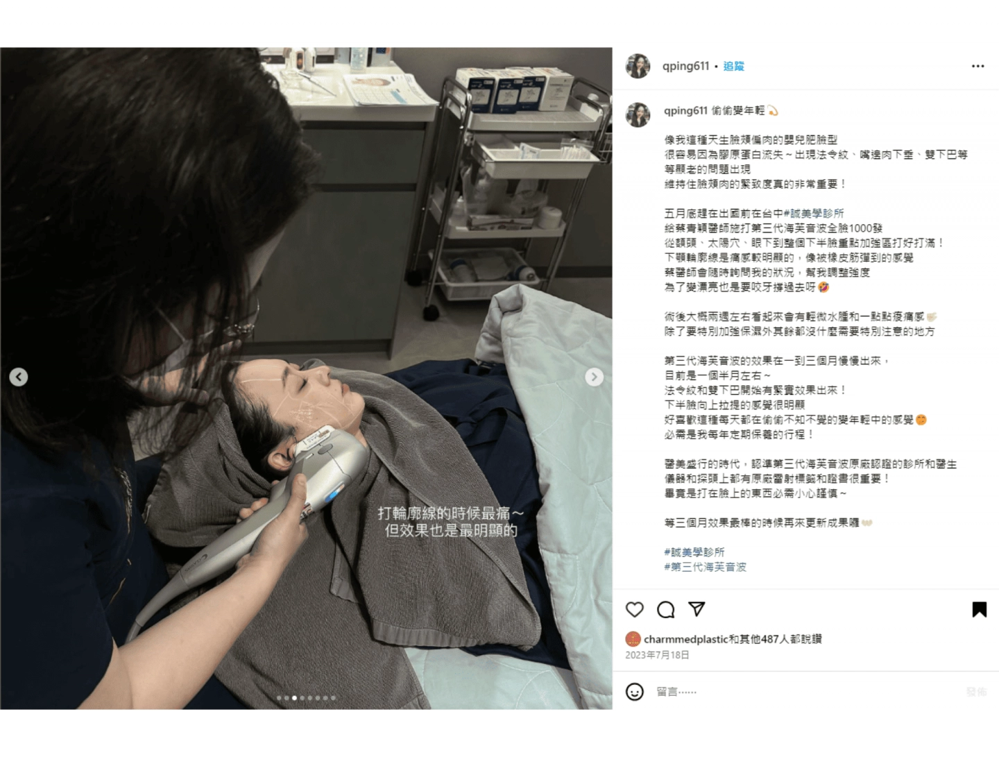 誠美學診所海芙音波蔡青穎醫師