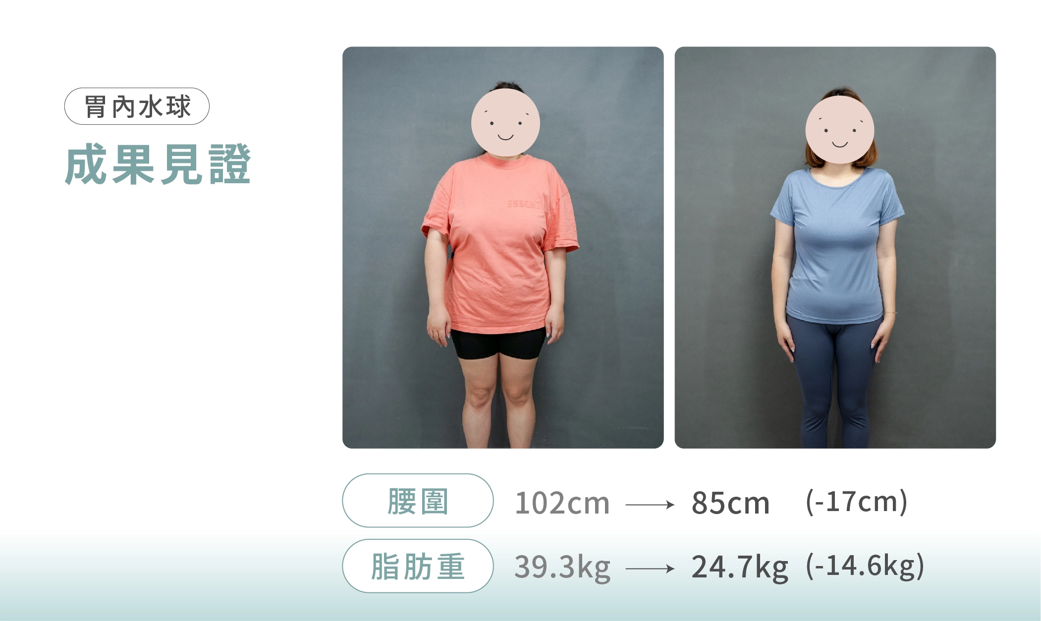 誠美學診所胃水球成果記錄