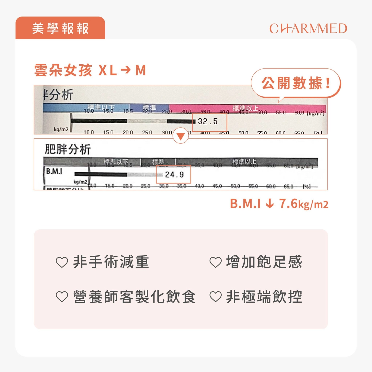誠美學胃水球置放術後數據公開