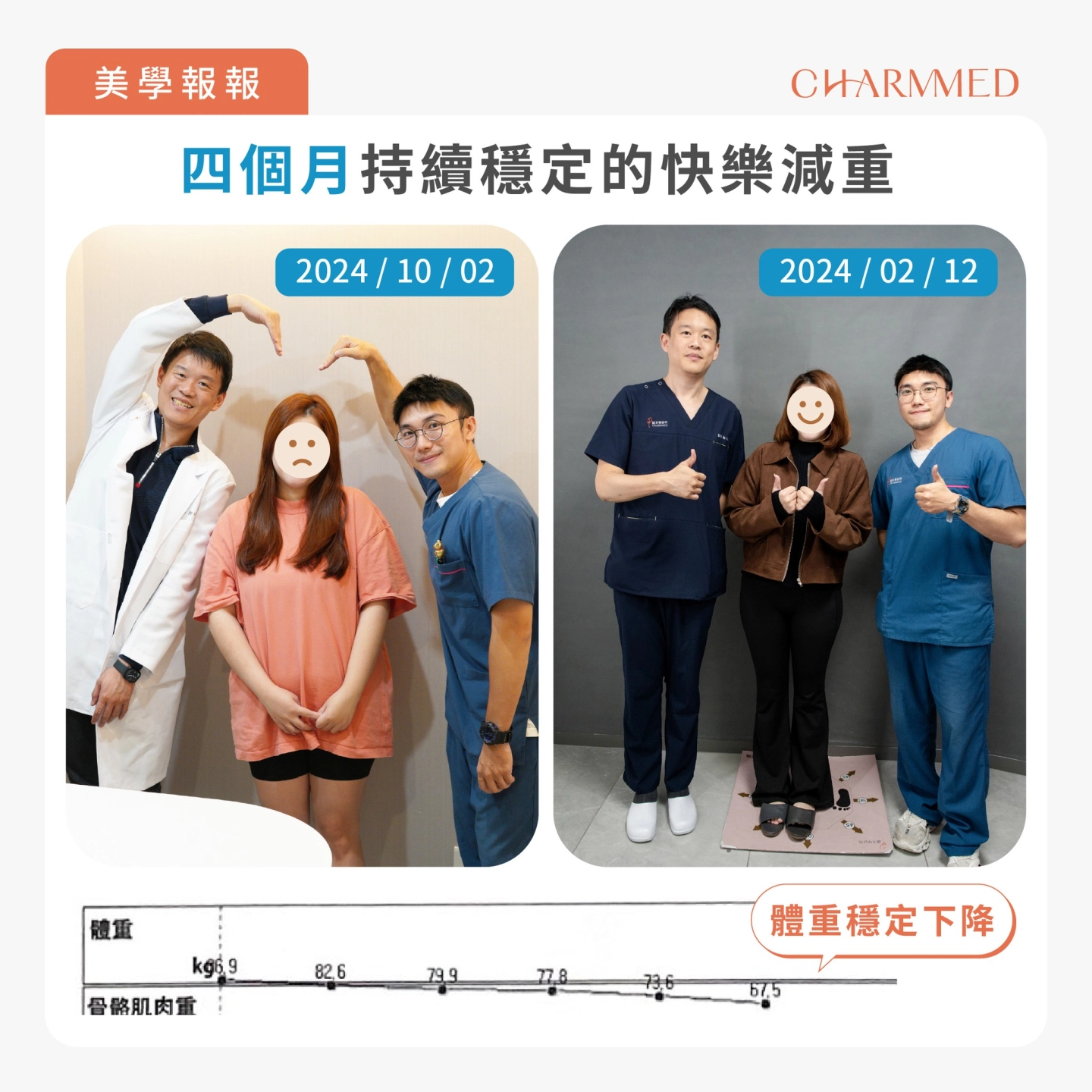 誠美學診所胃水球減重四個月成果見證