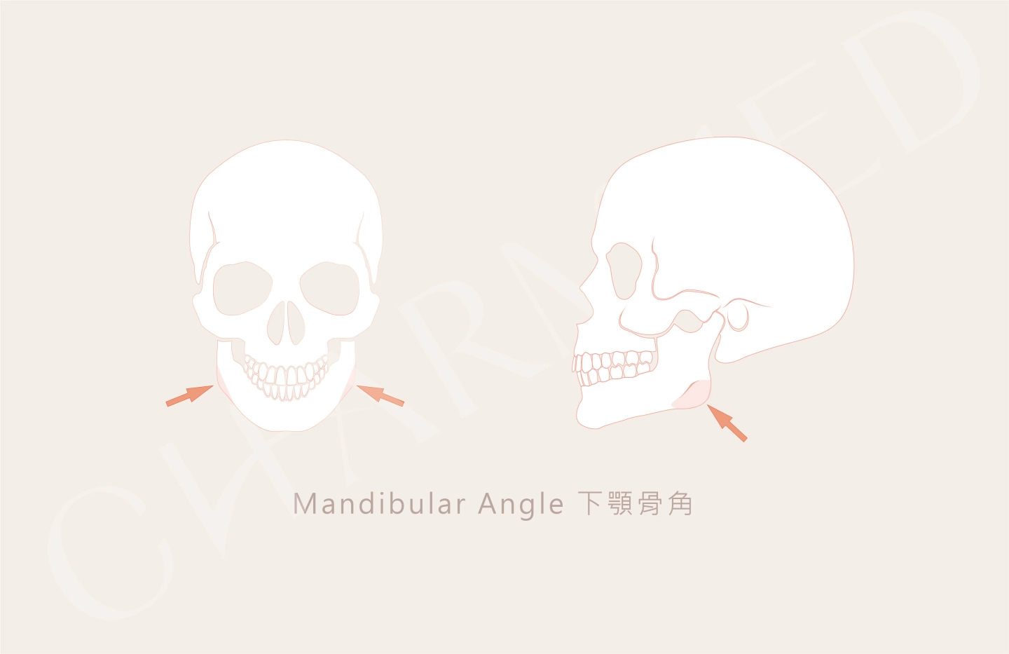 誠美學診所下頷骨削骨療程介紹