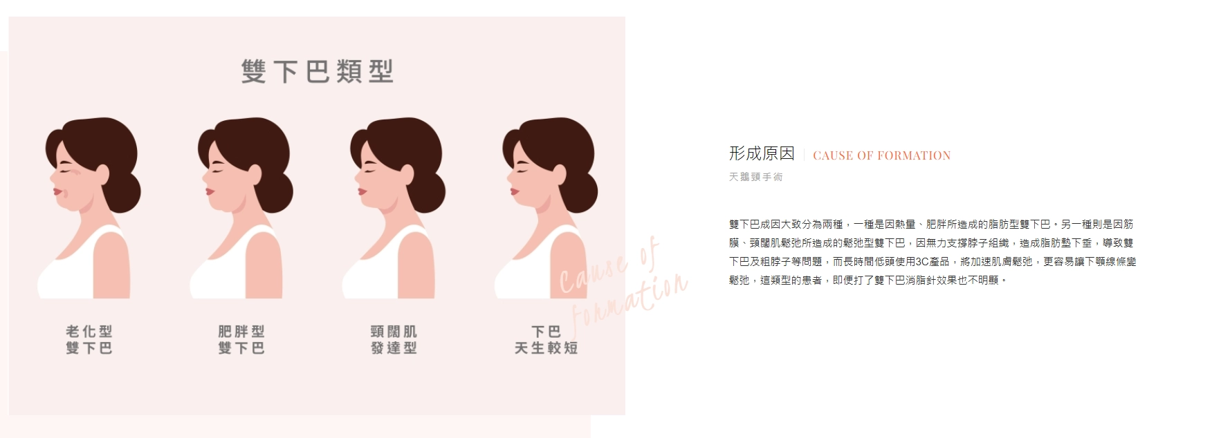 誠美學診所天鵝頸手術療程介紹