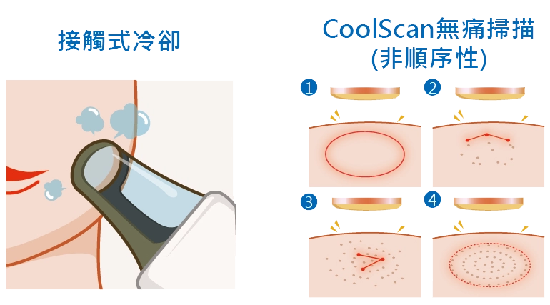 誠美學M22彩衝光介紹