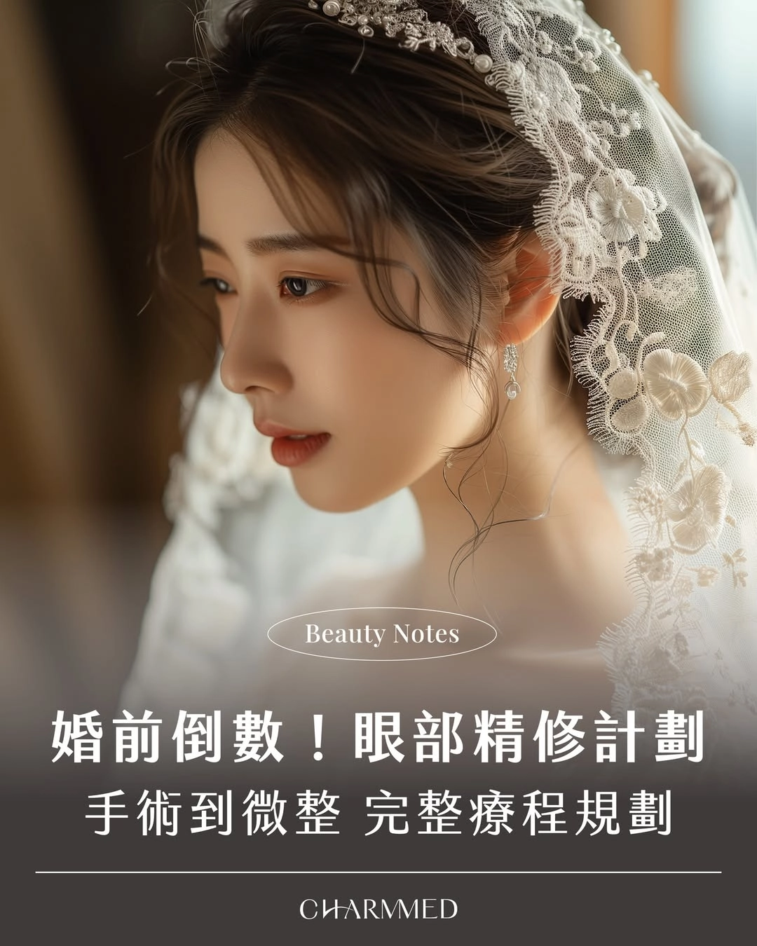 婚前變美倒數開始！眼部手術+微整6個月完整規劃