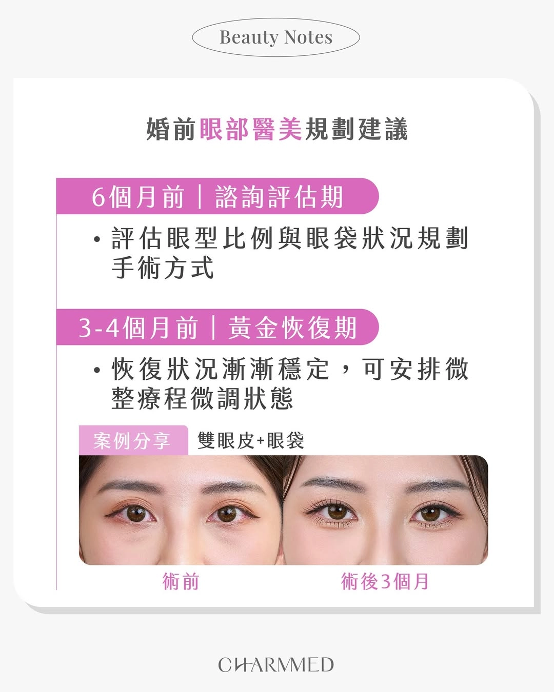 婚前變美倒數開始！婚前3-6個月