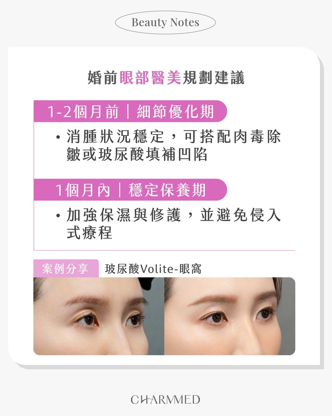 婚前變美倒數開始！婚前1-2個月