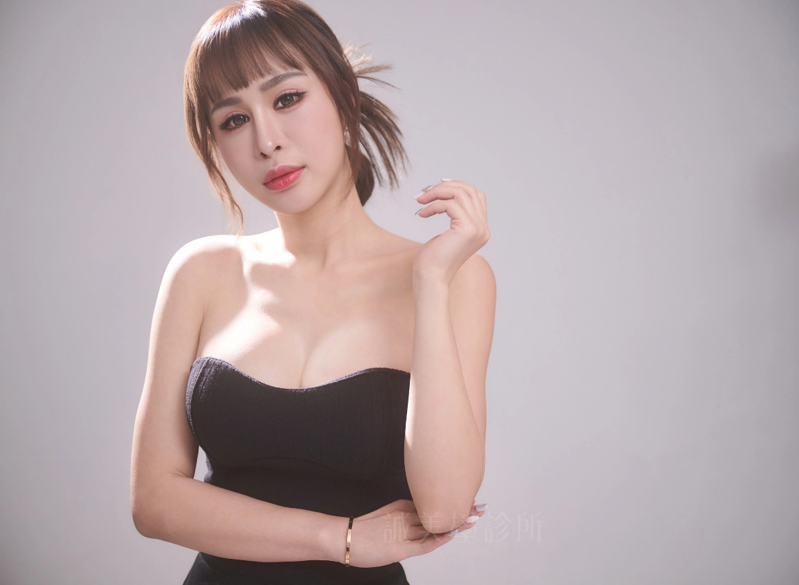 誠美學診所媽咪變身術女王波隆乳素人見證