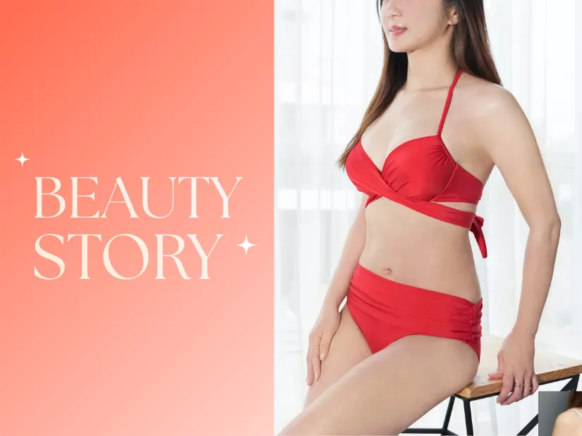 資深 整形外科林孟羲醫師-產後腹部拉皮 形體雕塑案例