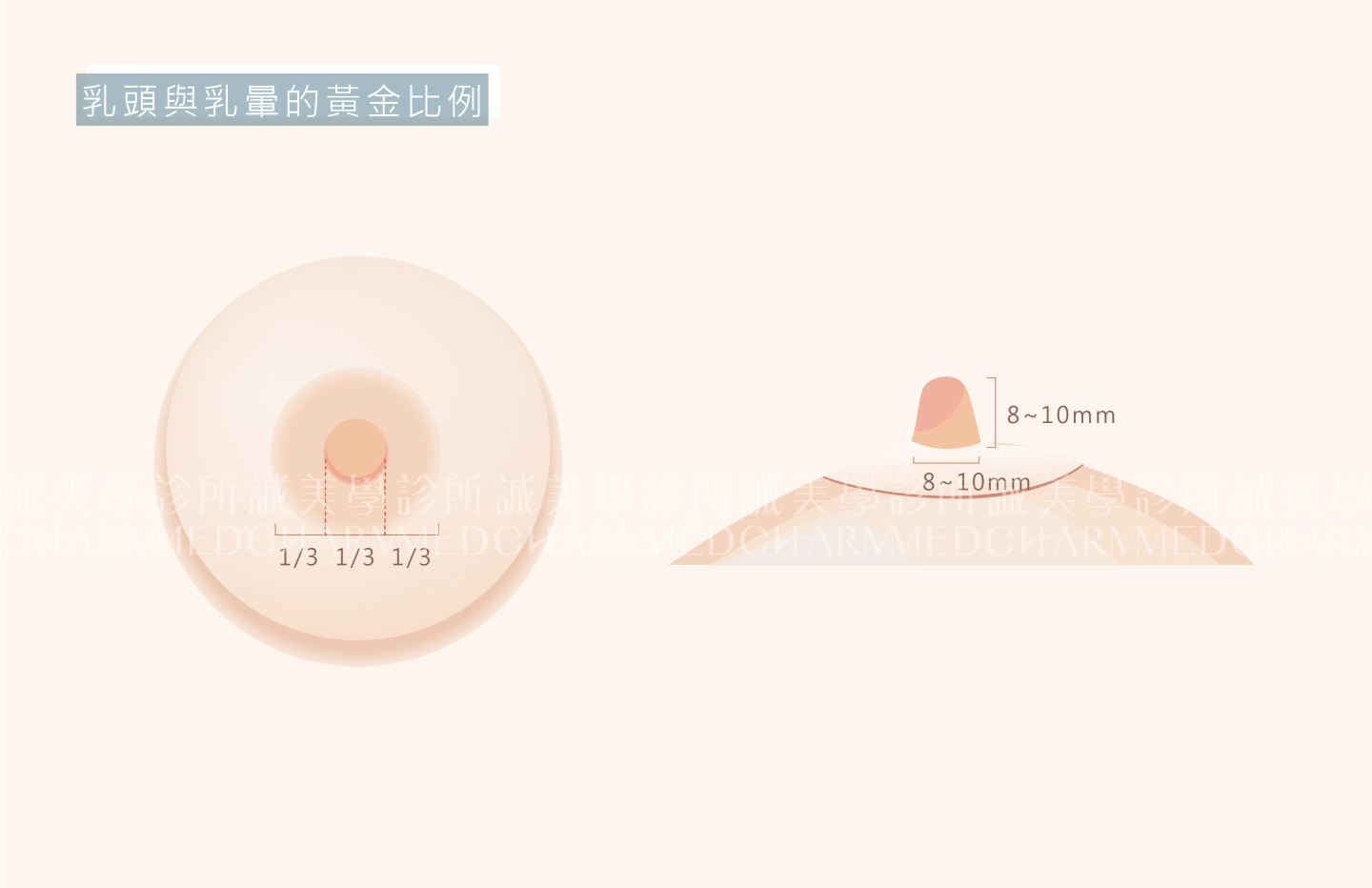 誠美學診所縮乳頭手術療程介紹