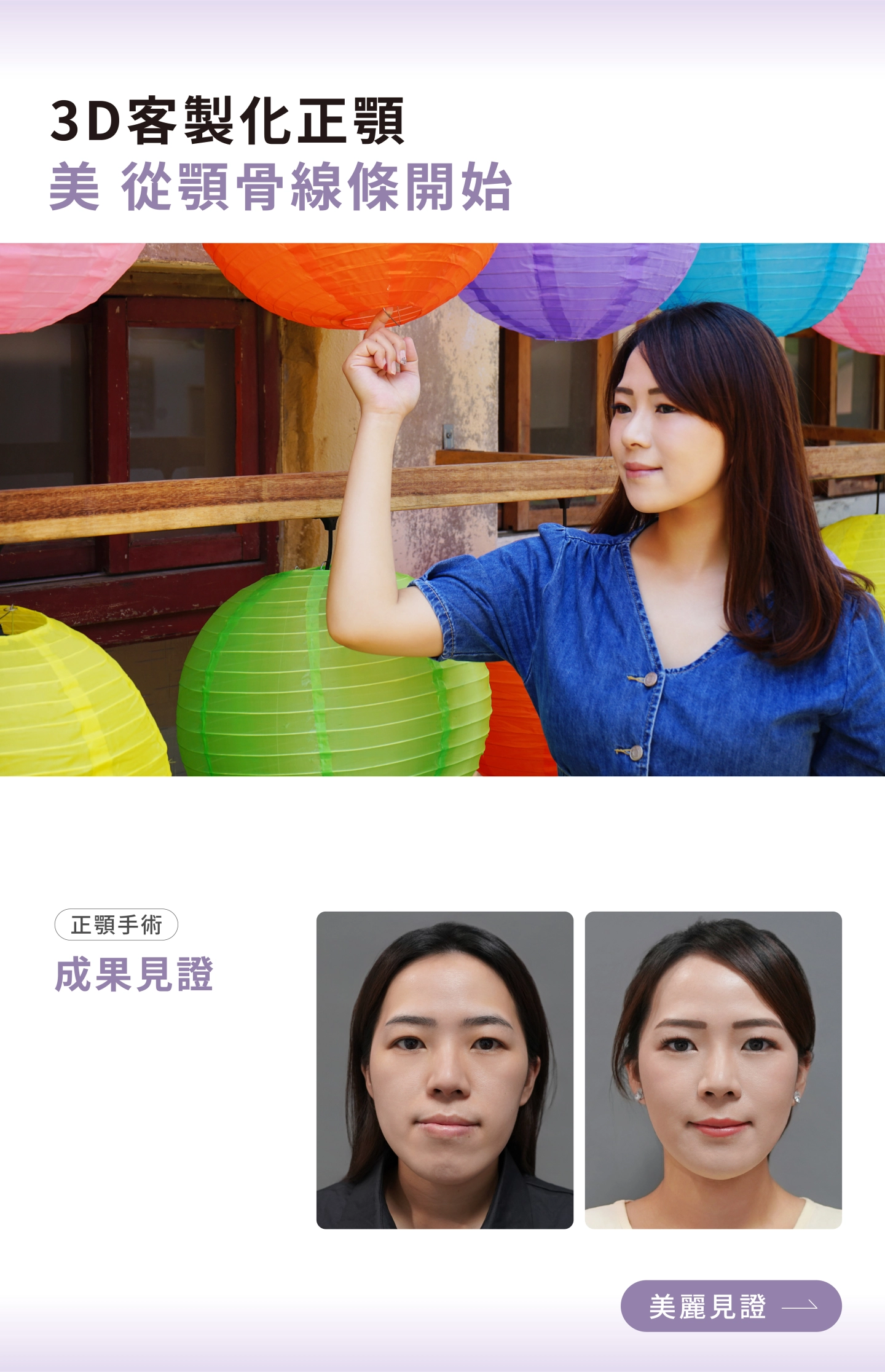 3D客製化正顎-台中誠美學診所正顎真實案例