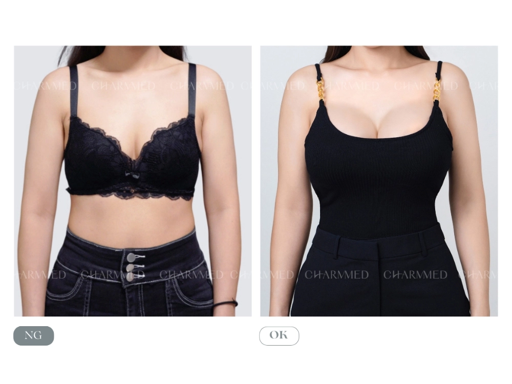 【誠美學診所】的隆乳美麗見證