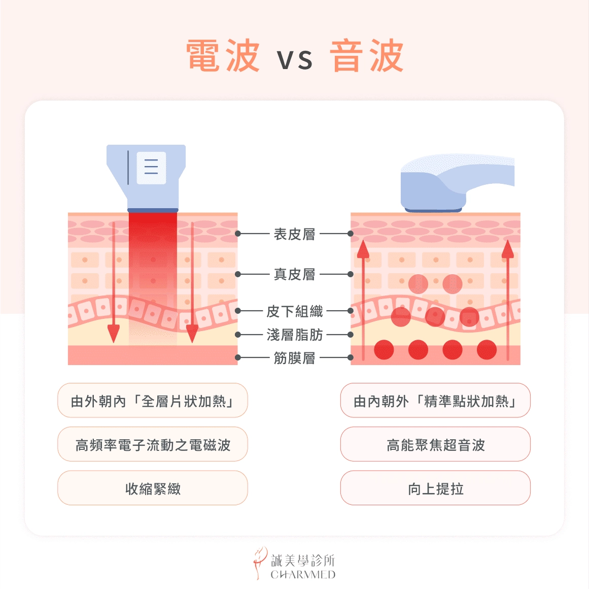 電波 vs 音波