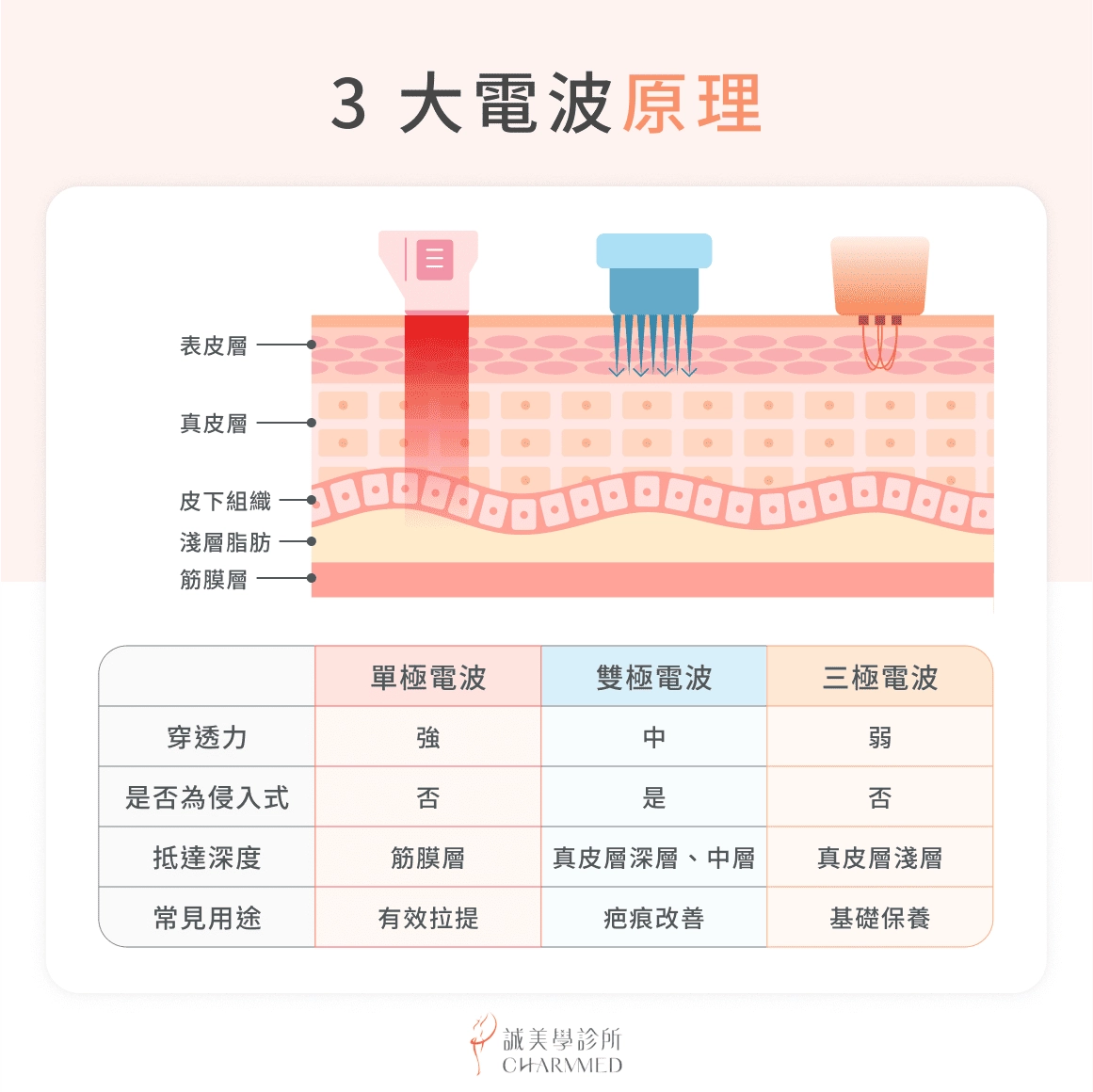 單極電波 vs 雙極電波 vs 三極電波
