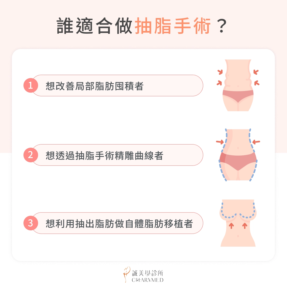 適合抽脂手術的 3 種族群
