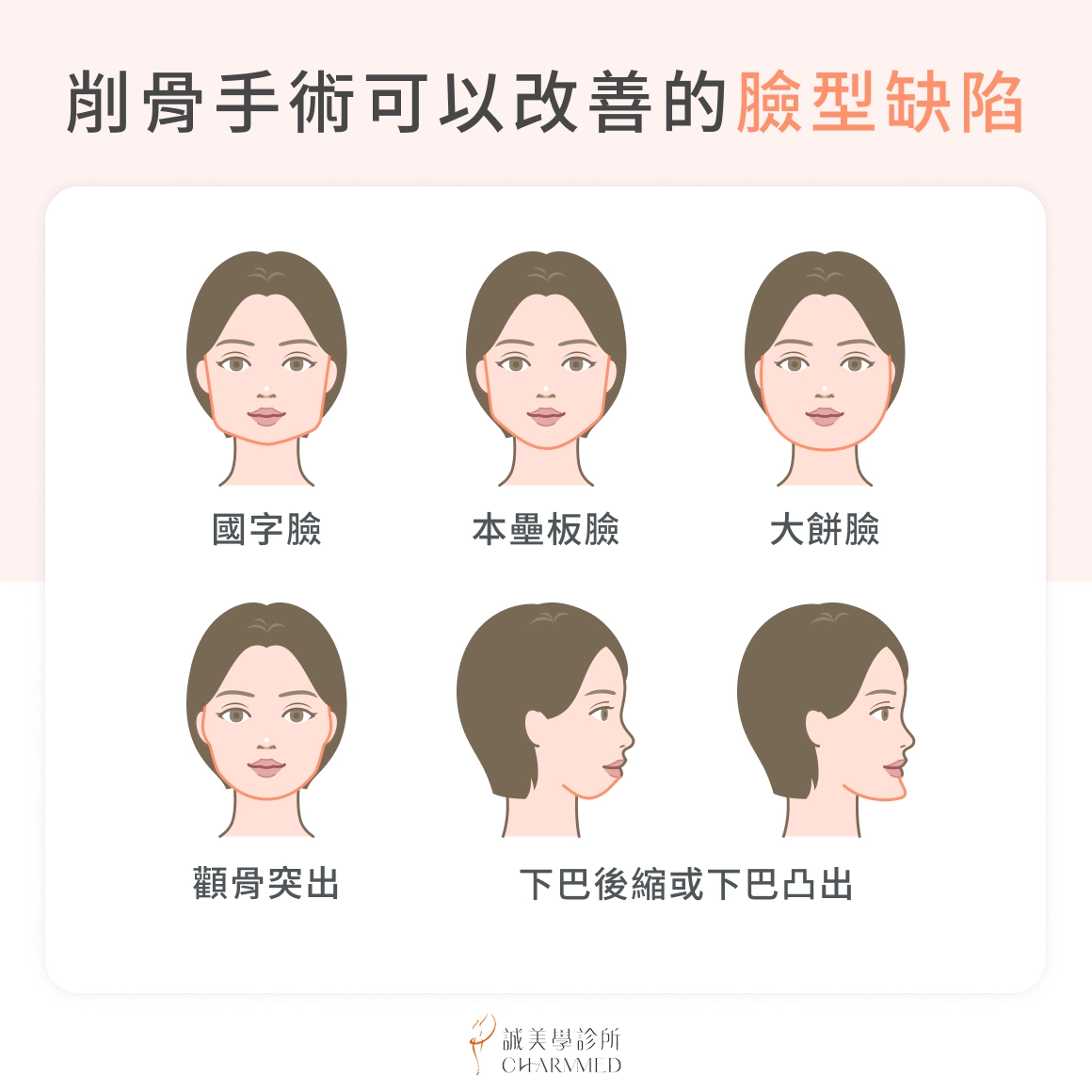 削骨手術可以改善的臉型缺陷