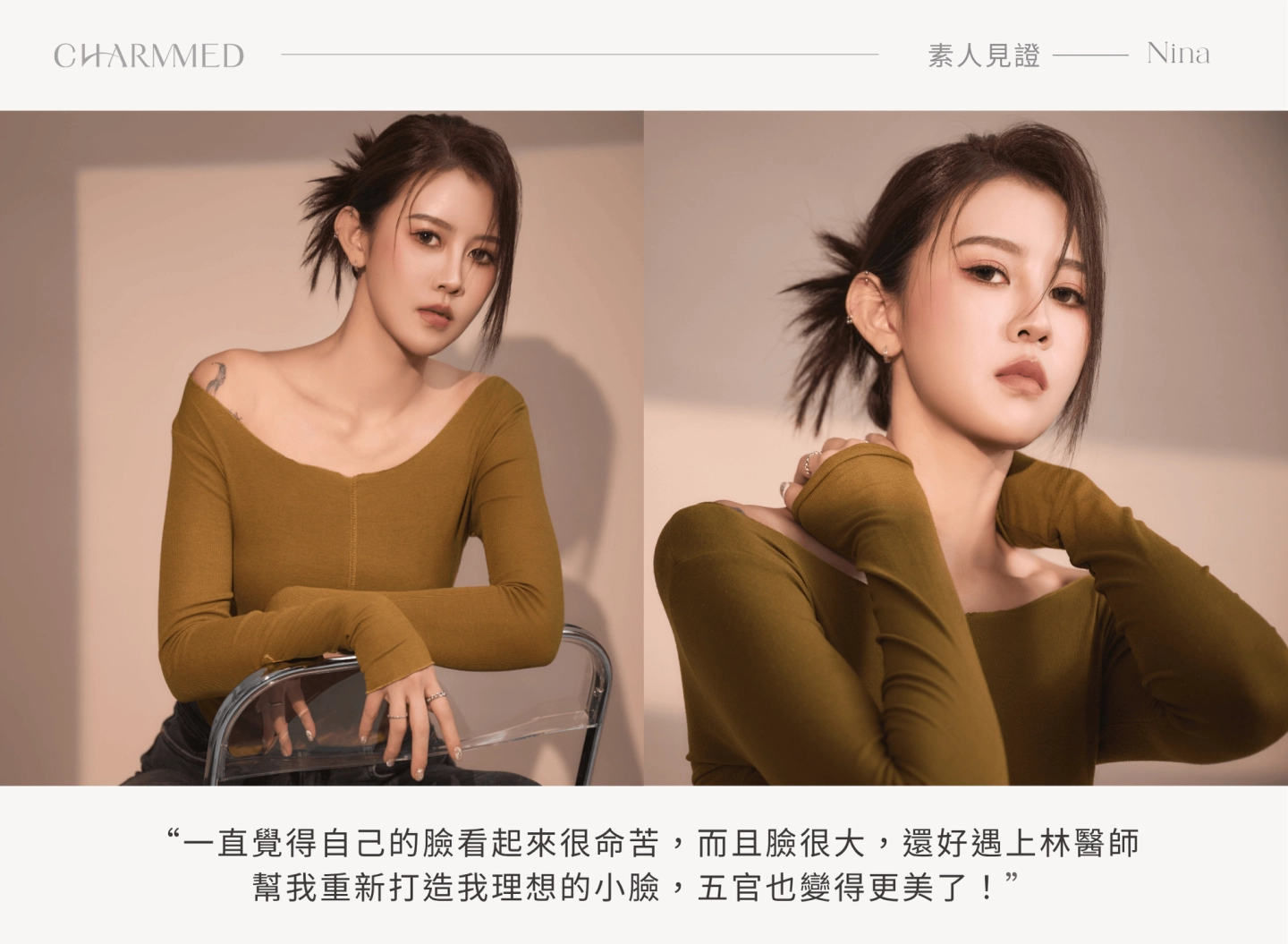誠美學削骨案例——上下削骨