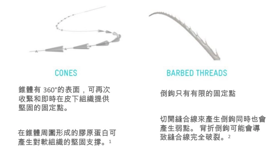 誠美學診所塑立愛立提線療程