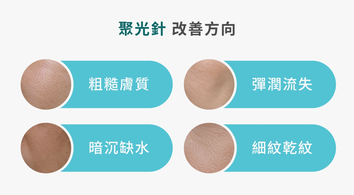 SKINVIVE聚光針改善方向