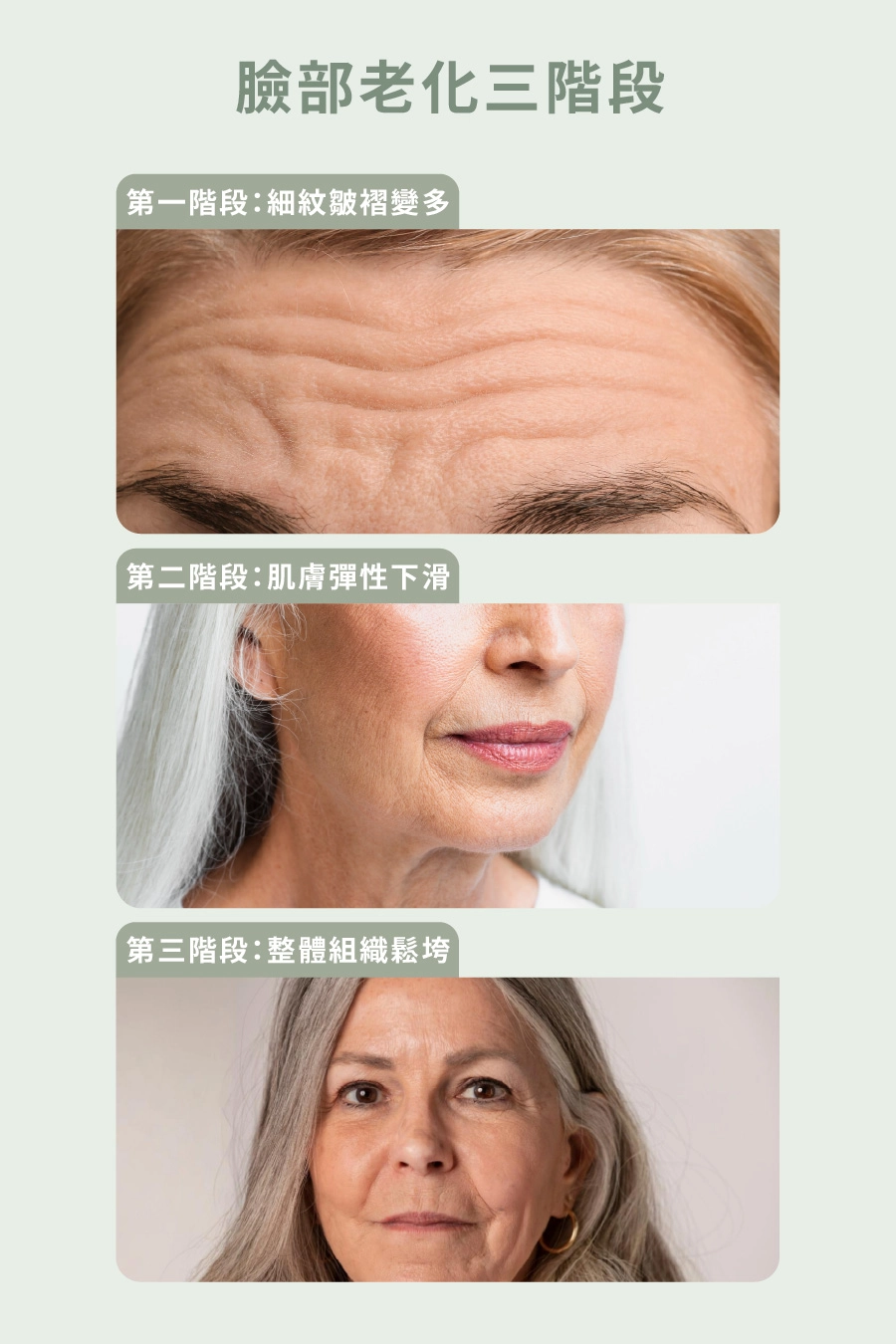 誠美學診所中下臉拉皮手術老化三步驟