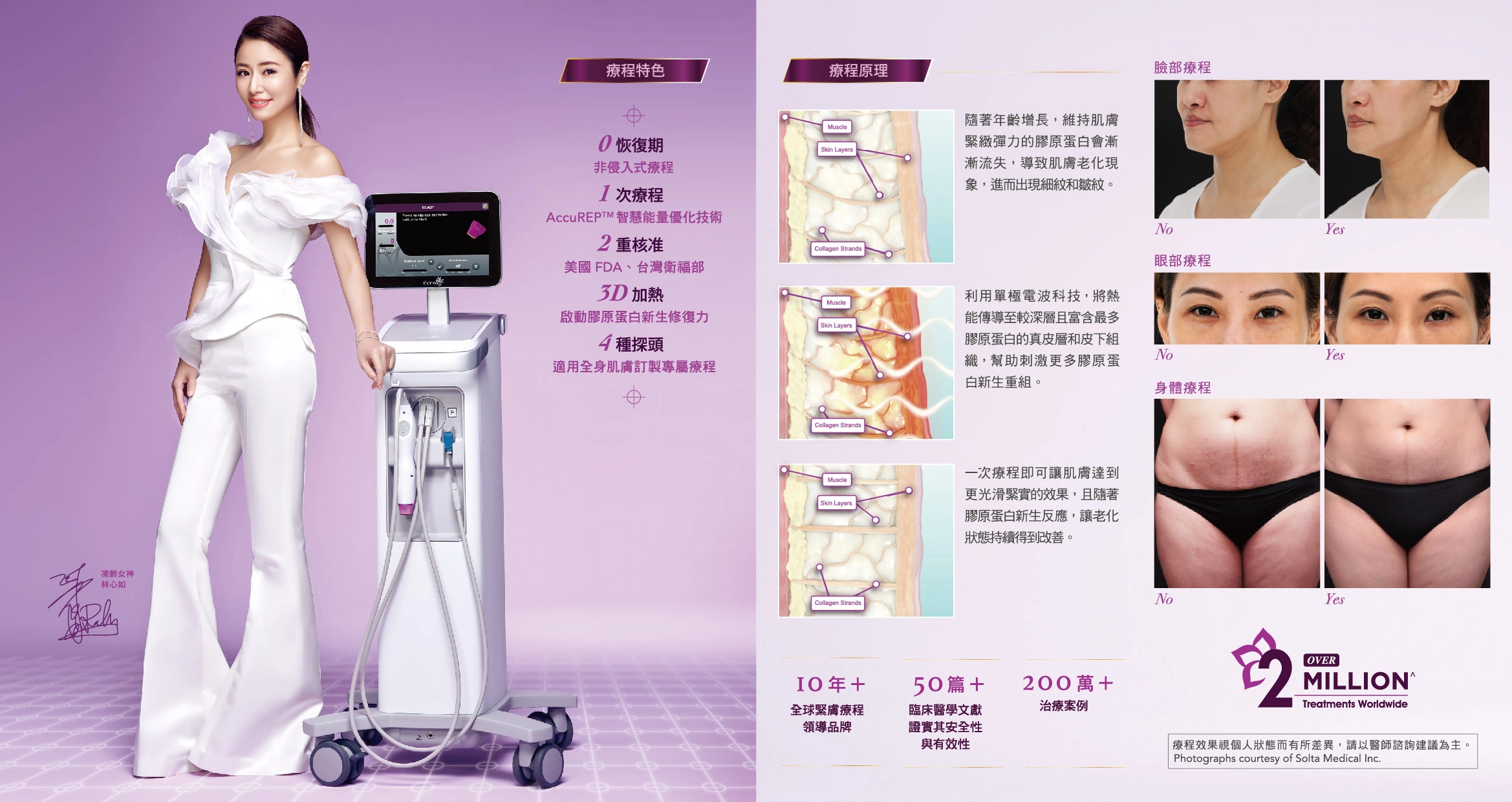 誠美學診所鳳凰電波機器